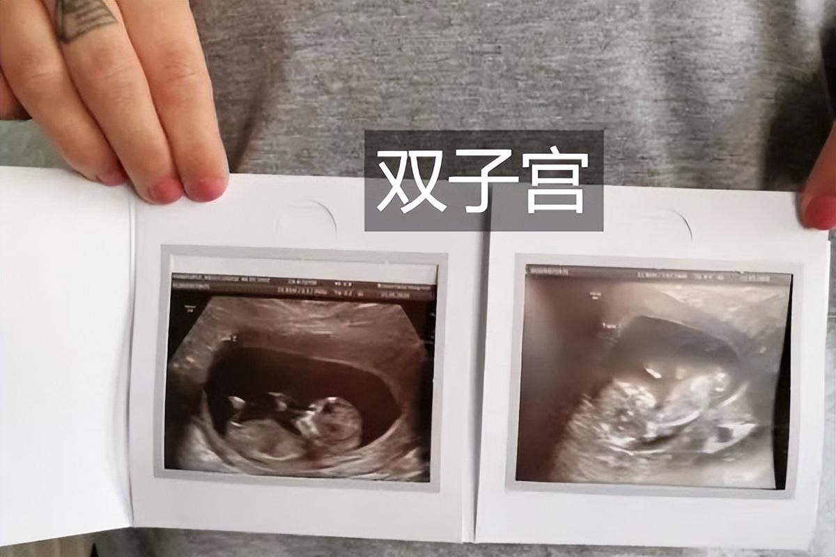 言多必失未必真，沉默是金更难撑打一正确生肖，详细解答、实证解答解释落实
